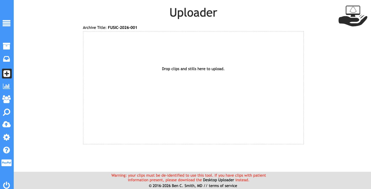SonoClipShare uploader drop zone with de-identification notice