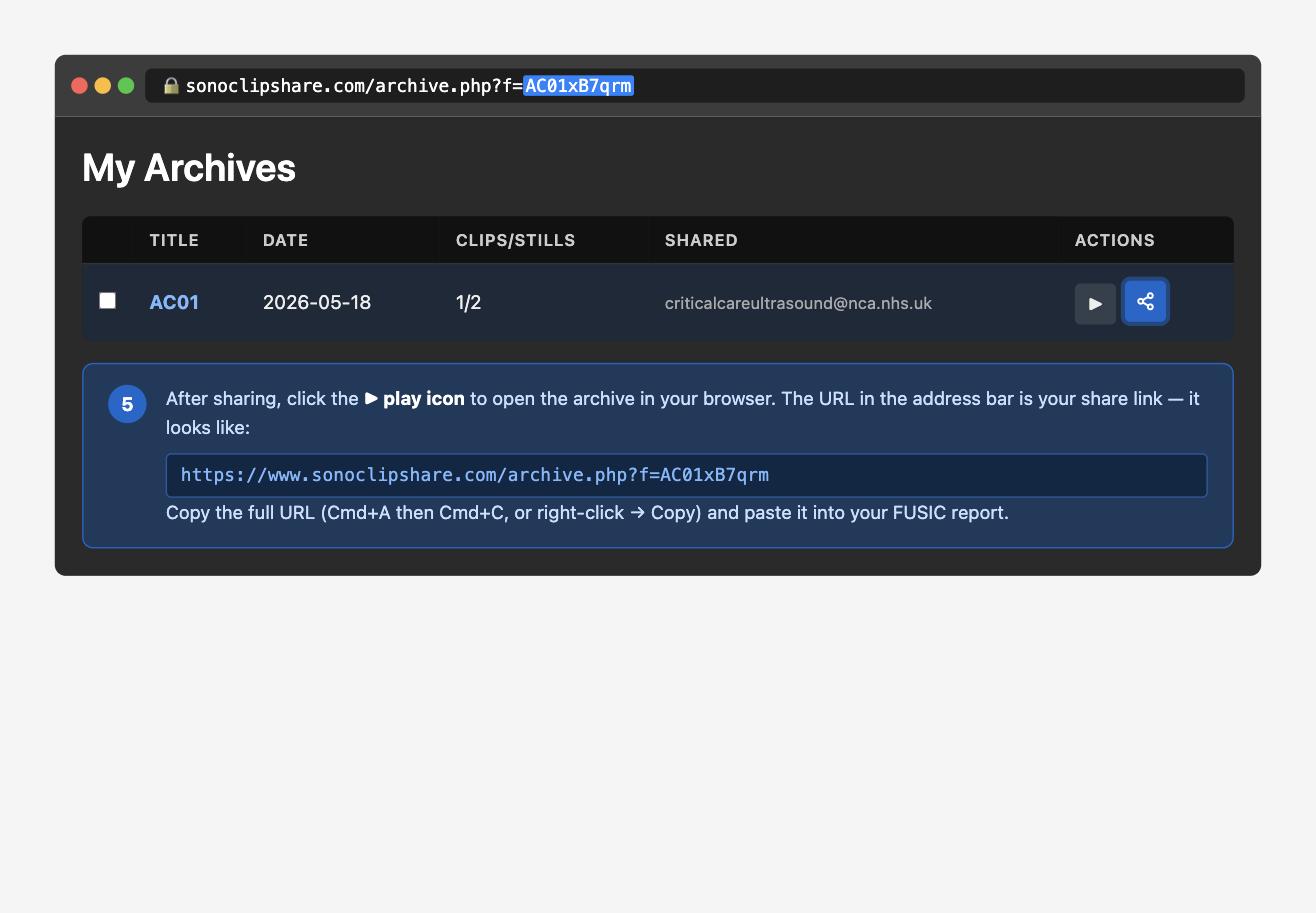 Annotated diagram showing the SonoClipShare archive URL in the browser address bar to copy