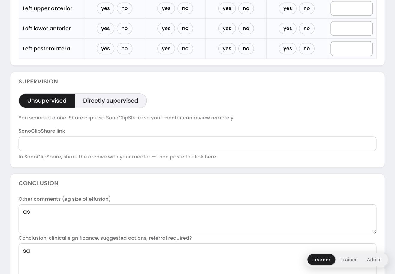 FUSIC report edit form showing the SonoClipShare link field in the Supervision section
